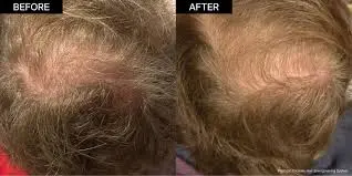 ahk cu powder hair care